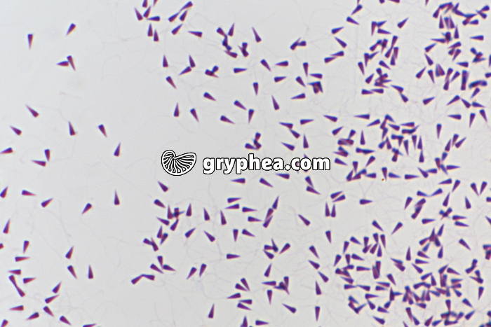 Oursin - Spermatozoïdes d'Oursin x400 - gryphea.com